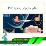 لقاح خارج از رحم یا IVF