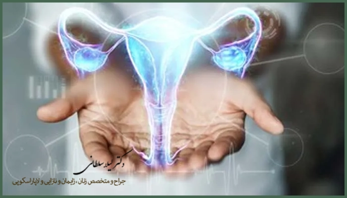 جراحی اندومتریوز