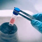 فریز تخمک