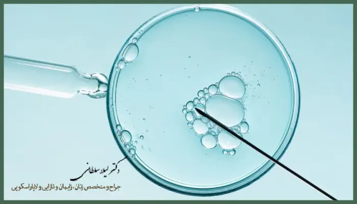 احتمال بارداری با ای وی اف چند درصد است