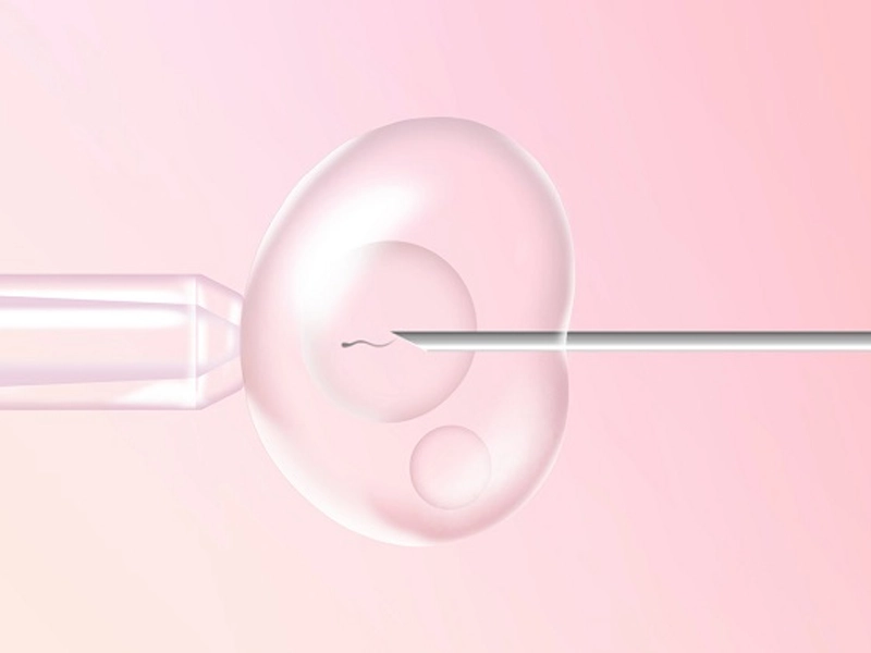 بارداری یا IVF در سن بالا