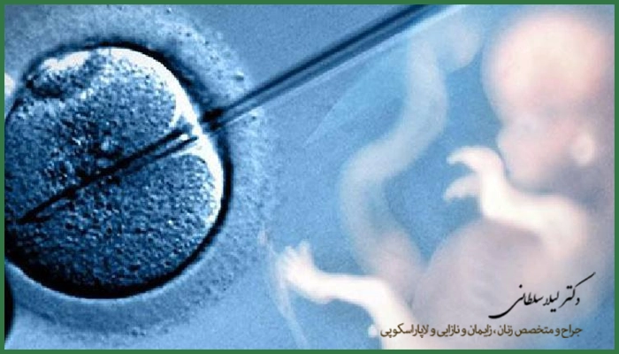 ضروری‌ترین مراقبت‌های بعد از IVF