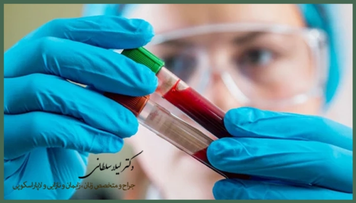 چرا فاصله زمانی بین دو آی وی اف مهم است؟
