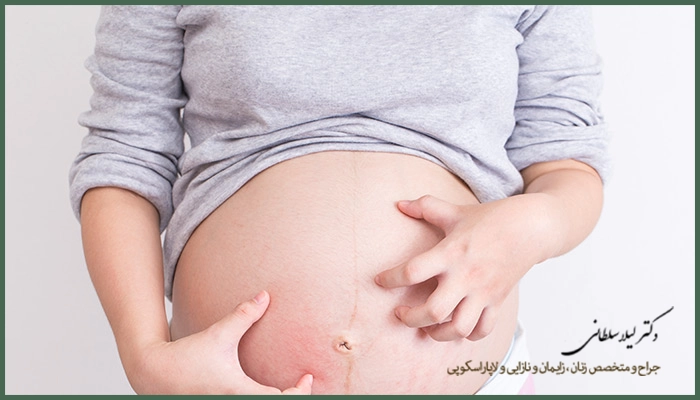 آی یو آی چگونه انجام میشود