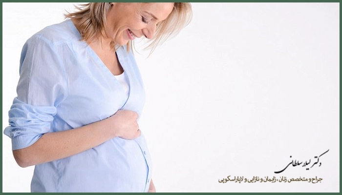 آی یو آی چیست