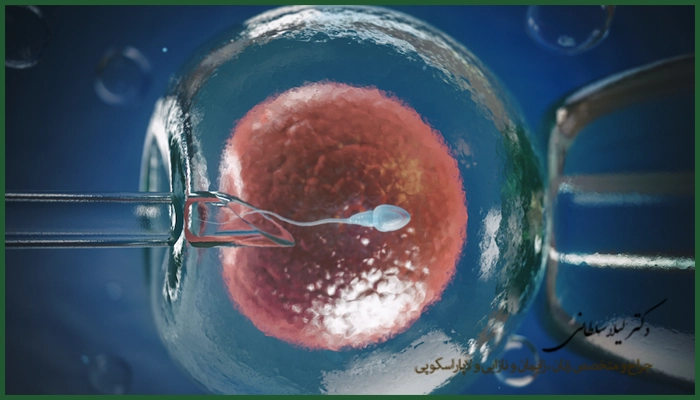 عمل IVF چقدر طول می‌کشد؟ 