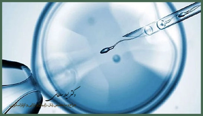 عوامل موثر بر تعیین هزینه ای وی اف