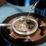 هزینه ای وی اف IVF و عوامل موثر بر آن