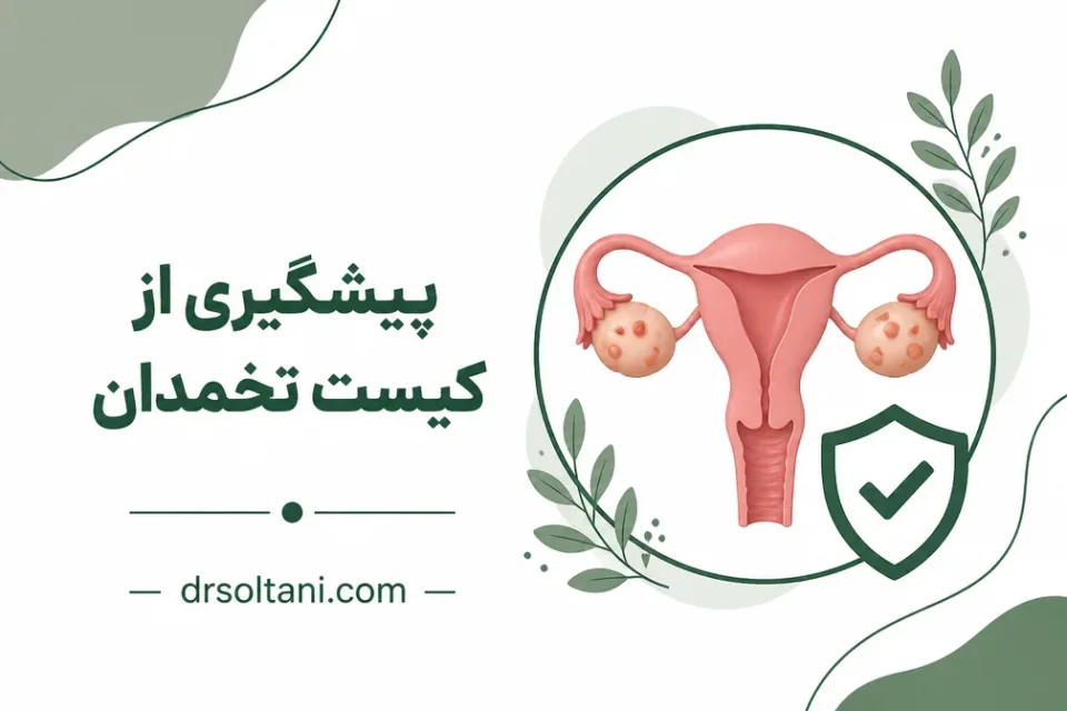 نمای توضیحی درباره اهمیت درمان به موقع کیست تخمدان